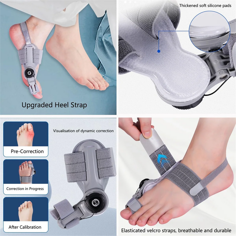 Adjustable Hallux Valgus Corrector